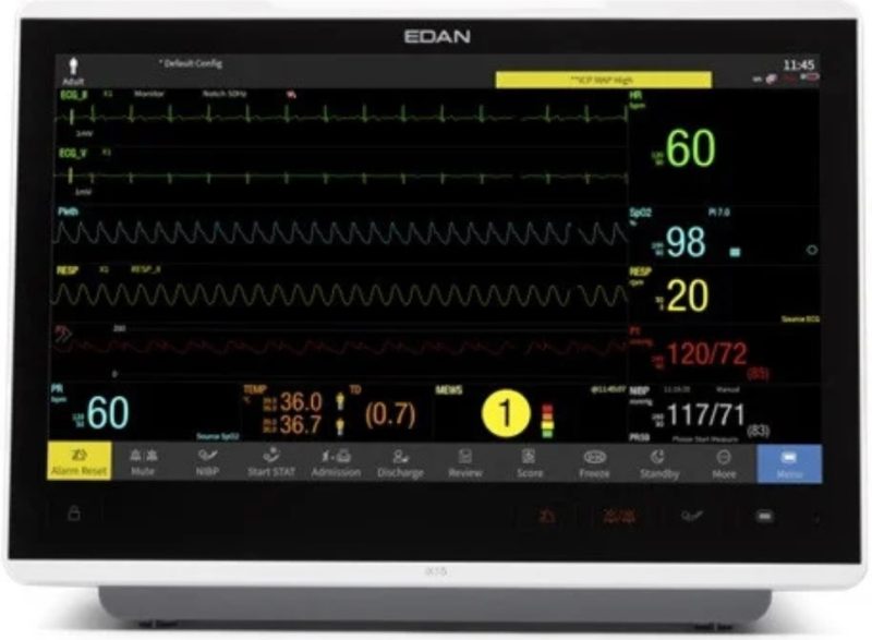 How Modern Patient Monitors Are Transforming ICU Care