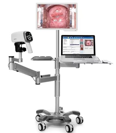 EDAN Digital Colposcope