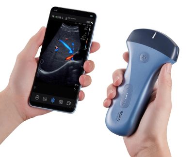 EDAN Ultrasound Pocket