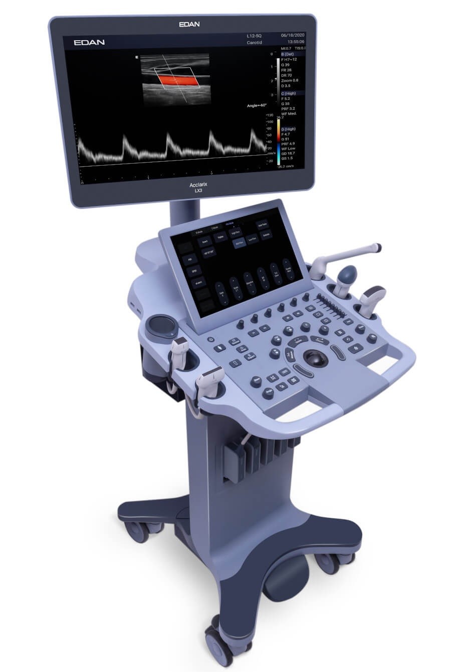 Ultrasound — Stand Alone